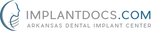 Link to Arkansas Dental Implant Center home page