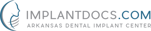 Link to Arkansas Dental Implant Center home page
